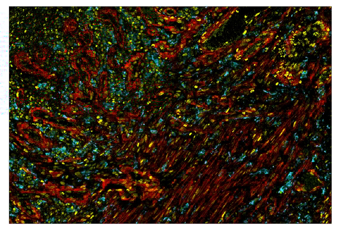 Immunohistochemistry Image 1: Phospho-Stat3 (Tyr705) (D3A7) & CO-0029-488 SignalStar<sup>™</sup> Oligo-Antibody Pair