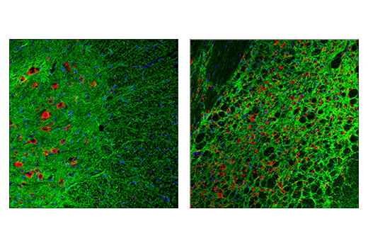 NCAM1 (CD56) (E7X9M) XP® Rabbit mAb | Cell Signaling Technology