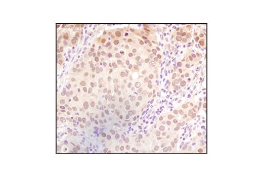 Immunohistochemistry Image 1: SUMO-1 Antibody