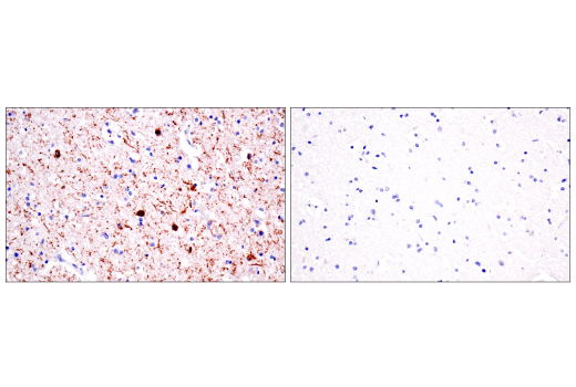 Immunohistochemistry Image 4: Phospho-Tau (Thr205) (E3E3B) Mouse Monoclonal Antibody