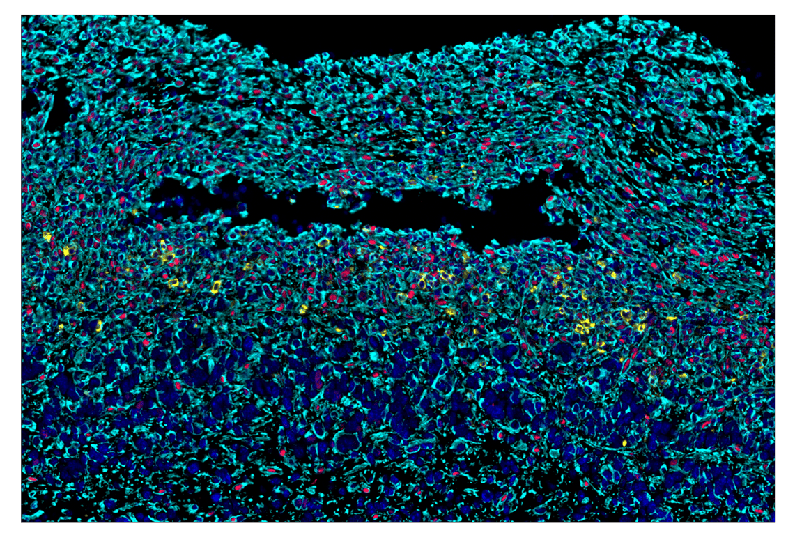 Immunohistochemistry Image 8: Phospho-SLP-76 (Ser376) (E3G9U) & CO-0018-488 SignalStar<sup>™</sup> Oligo-Antibody Pair