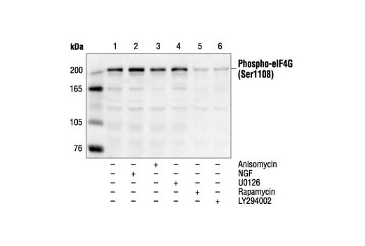 undefined Image 12: Translation Initiation Complex Antibody Sampler Kit