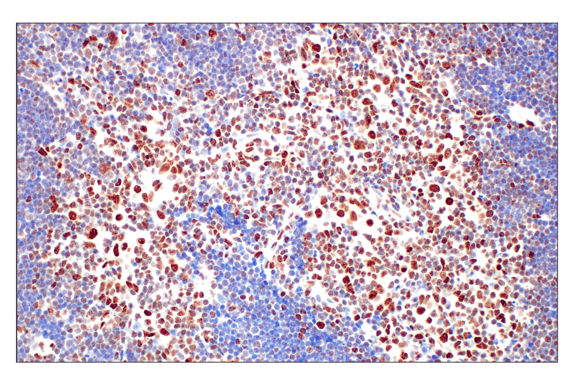 Immunohistochemistry Image 2: Tri-Methyl-Histone H3 (Lys27) (C36B11) Rabbit mAb