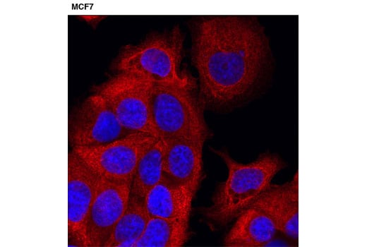 Immunofluorescence Image 1: Pan-Keratin (C11) Mouse mAb (Alexa Fluor<sup>®</sup> 555 Conjugate)