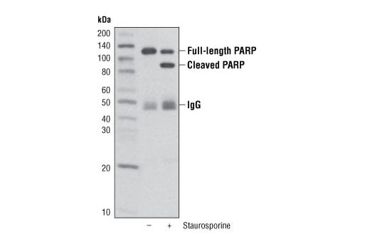 Immunoprecipitation Image 2: PARP (46D11) Rabbit Monoclonal Antibody (Sepharose<sup>®</sup> Bead Conjugate)