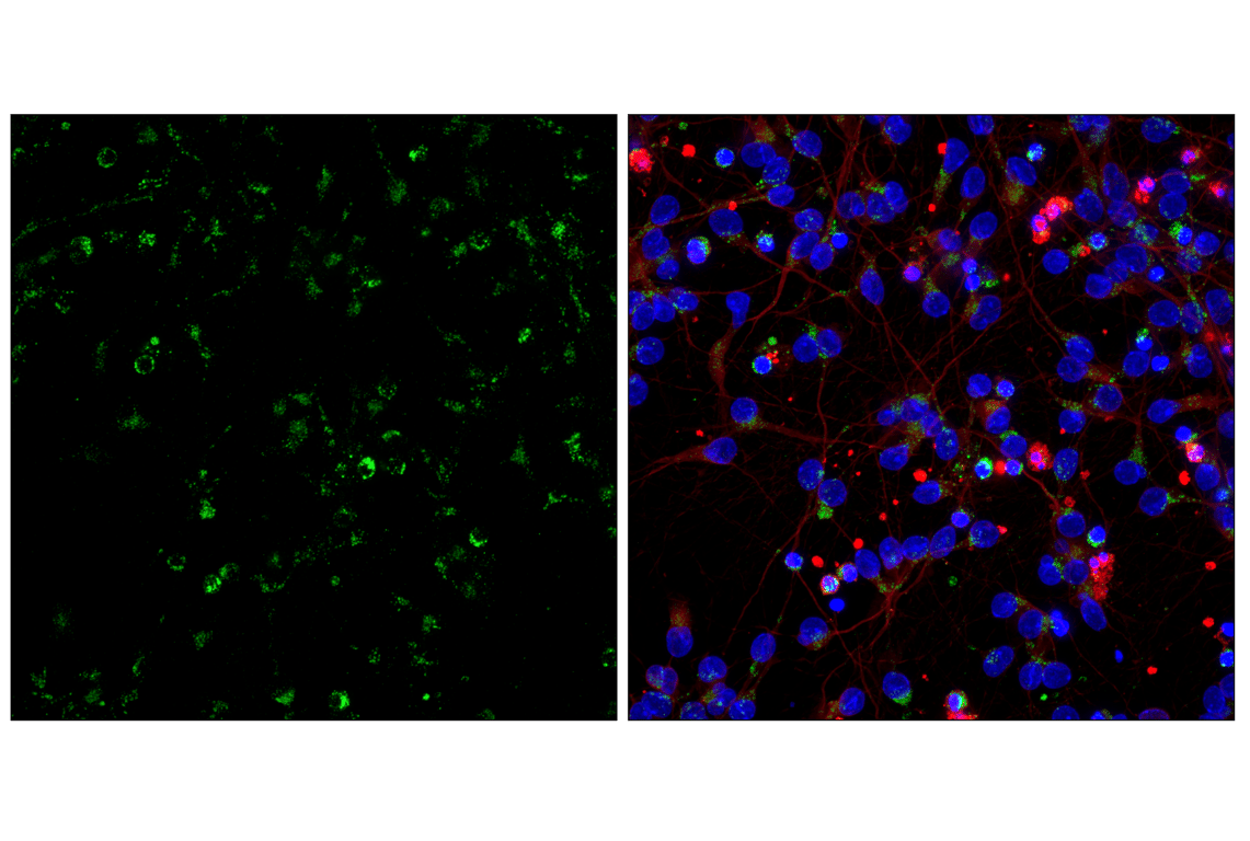 undefined Image 52: Organelle Localization IF Antibody Sampler Kit