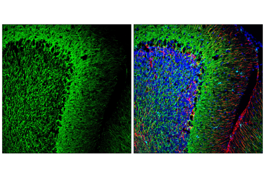Immunofluorescence Image 1: Neurofilament-M (E9N8K) Mouse Monoclonal Antibody