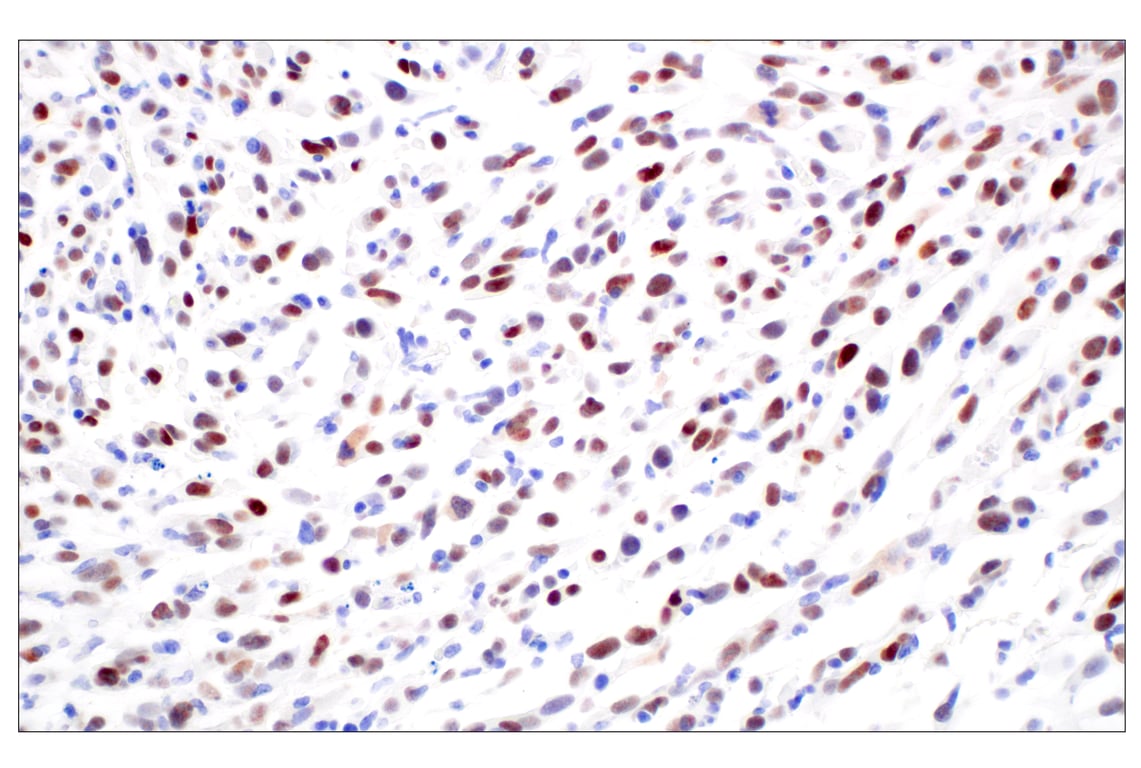 Immunohistochemistry Image 3: FOXG1 (E2W8P) Rabbit Monoclonal Antibody