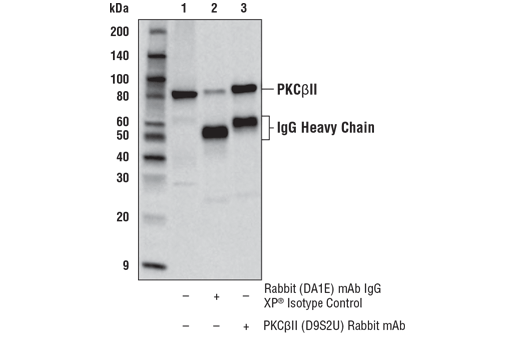 Immunoprecipitation Image 1: PKC betaII (D9S2U) Rabbit Monoclonal Antibody