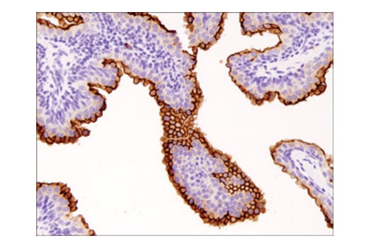 Immunohistochemistry Image 4: DPP4/CD26 (D6D8K) Rabbit Monoclonal Antibody (IHC Formulated)