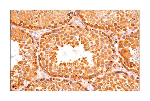 undefined Image 36: Ferroptosis Antibody Sampler Kit