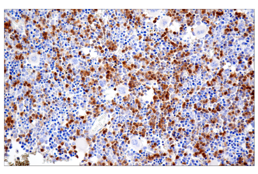 Immunohistochemistry Image 1: Ly-6G (E6Z1T) Rabbit Monoclonal Antibody (BSA and Azide Free)