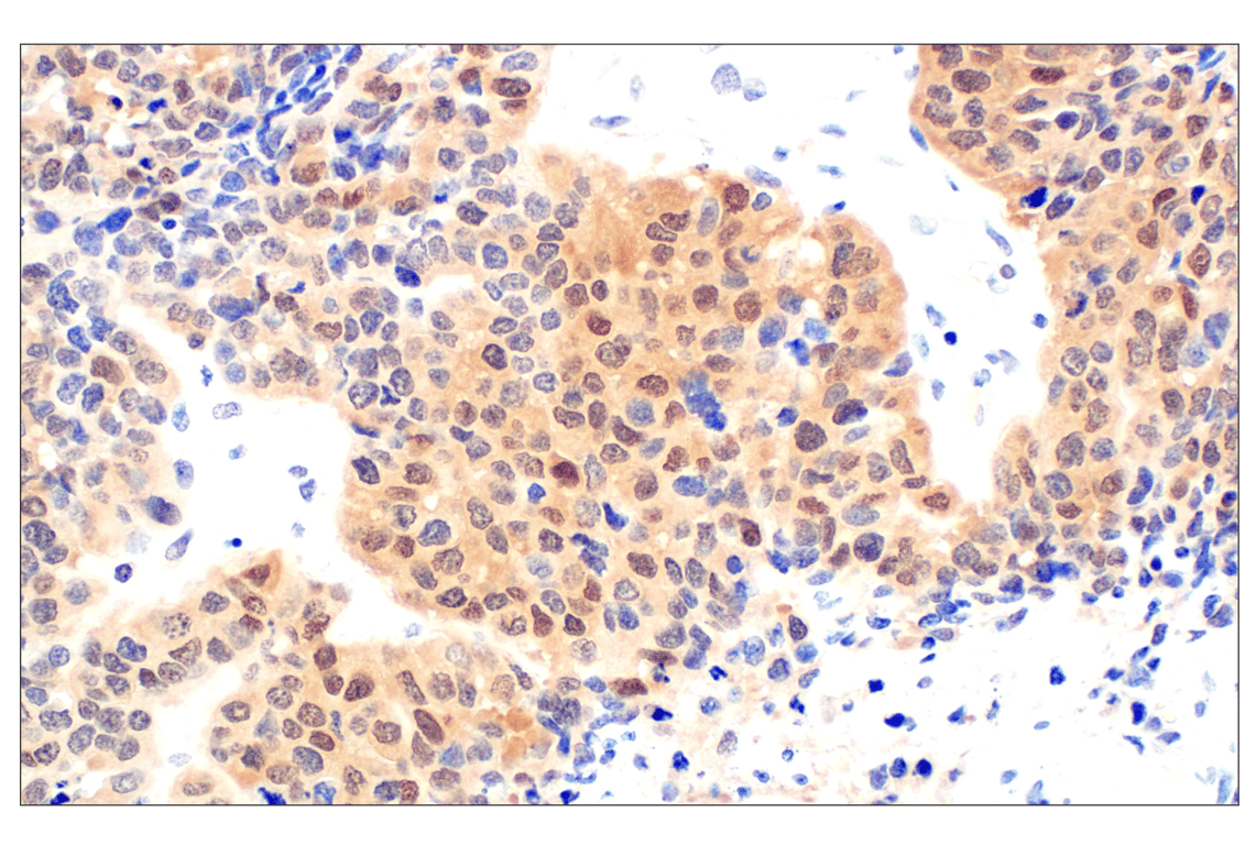 Immunohistochemistry Image 3: CDK6 (E3E3Q) Rabbit Monoclonal Antibody (BSA and Azide Free)