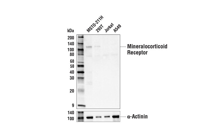 undefined Image 7: Steroid Hormone Receptor Antibody Sampler Kit