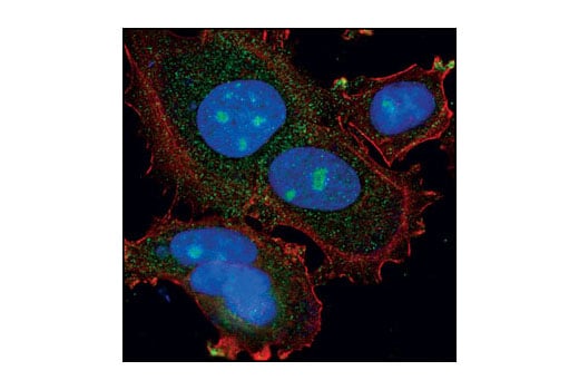 Immunofluorescence Image 1: PA28 beta Antibody