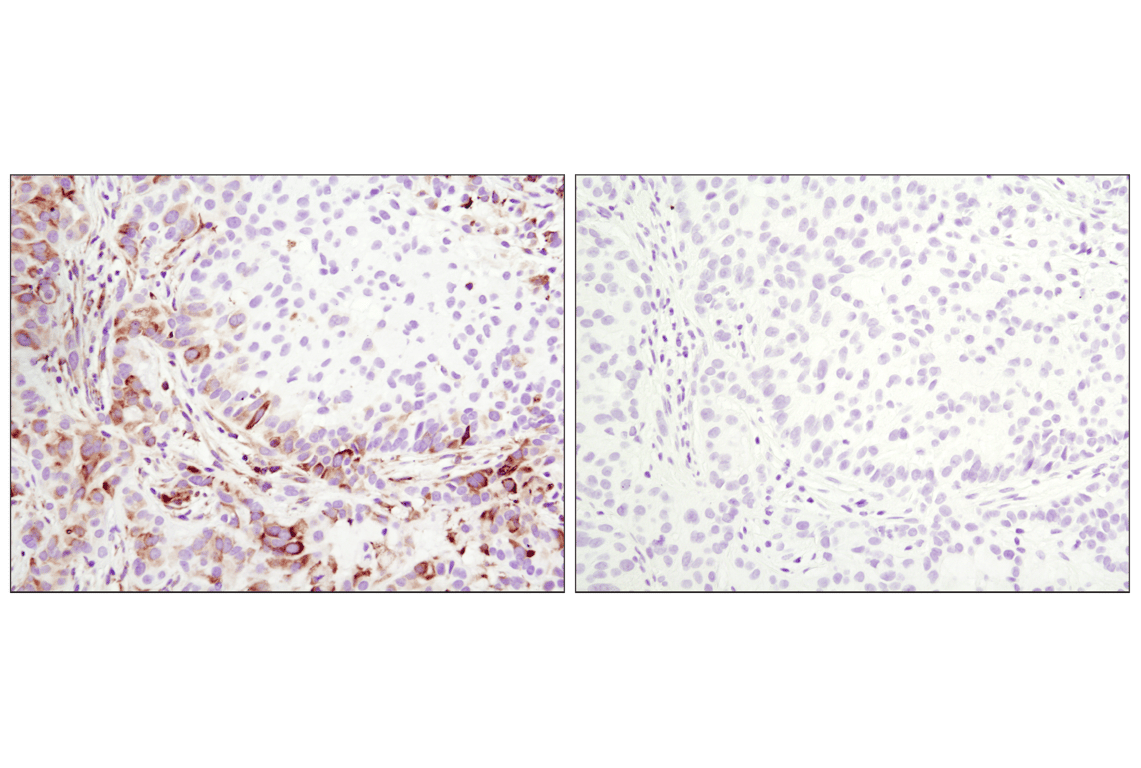 undefined Image 43: Translational Control Antibody Sampler Kit