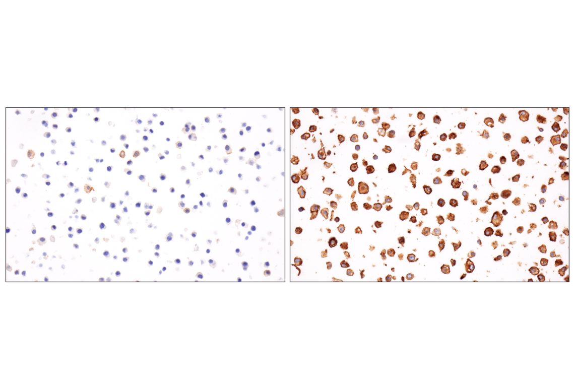 Immunohistochemistry Image 6: PD-L1 (F3Z1T) Rabbit Monoclonal Antibody (IHC Formulated)