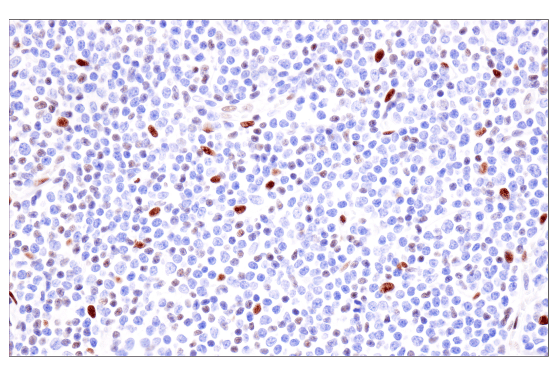 Immunohistochemistry Image 2: ADAR2 (F6U8S) Rabbit Monoclonal Antibody