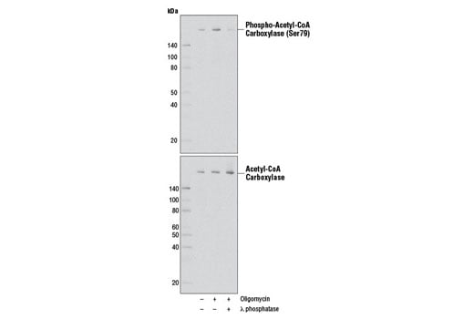 Western Blotting Image 1: Phospho-Acetyl-CoA Carboxylase (Ser79) (D7D11) Rabbit mAb (BSA and Azide Free)