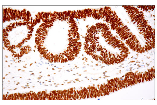 Immunohistochemistry Image 1: PBRM1/BAF180 (D4L9X) Rabbit Monoclonal Antibody