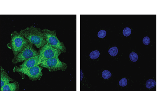 Immunofluorescence Image 1: Alix (E6P9B) Rabbit Monoclonal Antibody