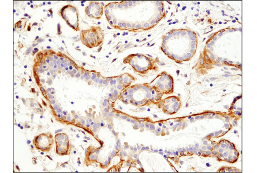 Immunohistochemistry Image 1: Palladin (D9H2) Rabbit Monoclonal Antibody