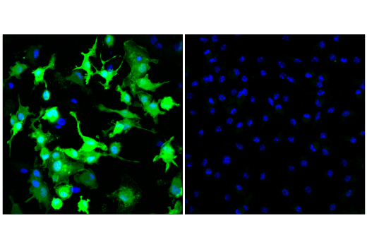 Immunofluorescence Image 1: Arginase-1 (D4E3M<sup>™</sup>) Rabbit Monoclonal Antibody (Alexa Fluor<sup>®</sup> 488 Conjugate)