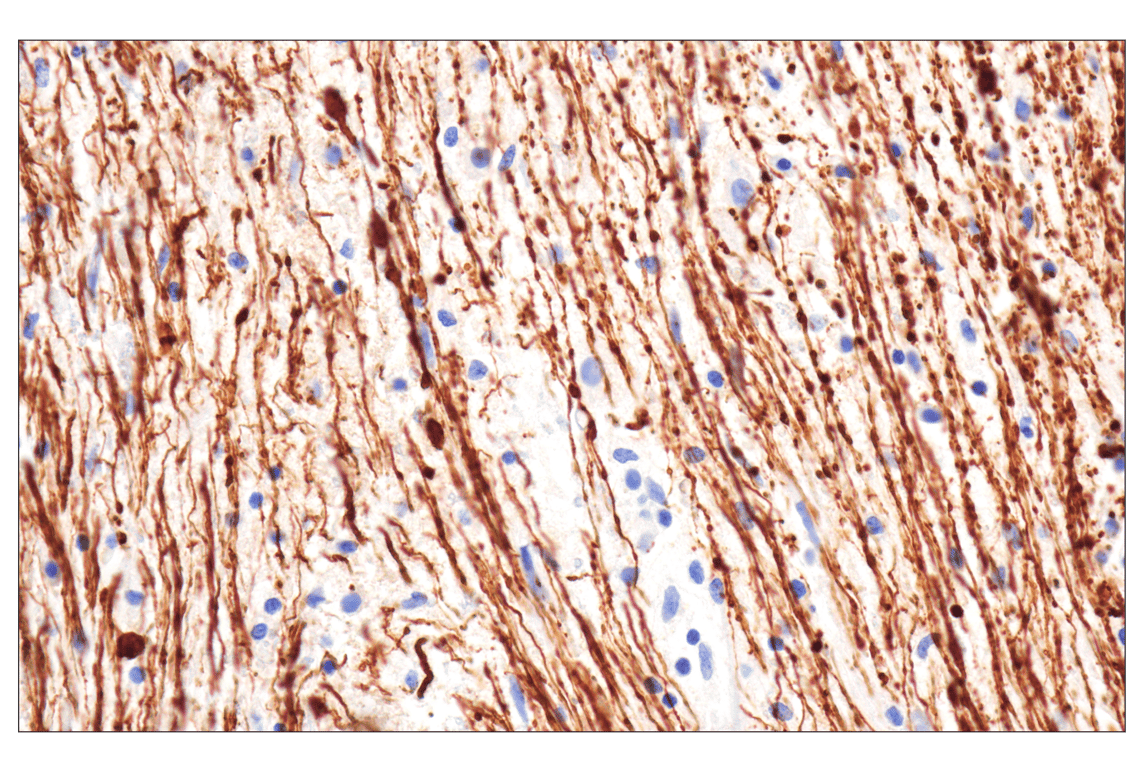 Immunohistochemistry Image 1: Neurofilament-M (E7Y8W) Mouse Monoclonal Antibody
