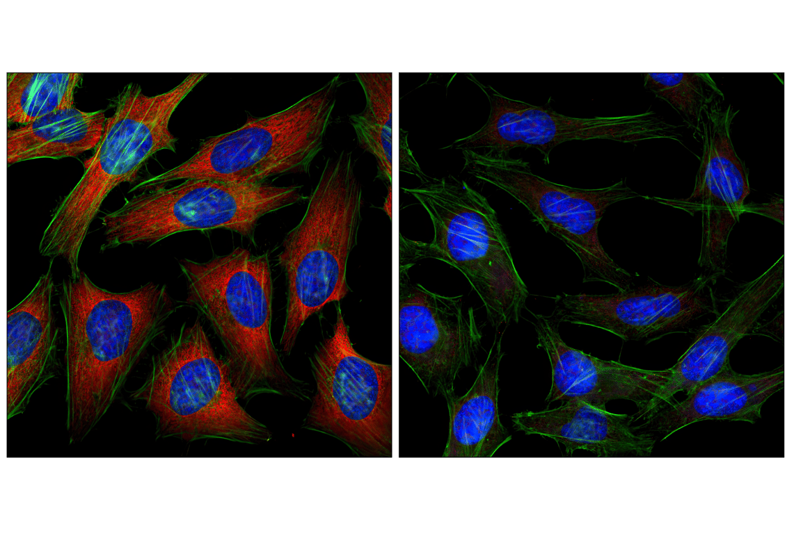 Immunofluorescence Image 1: S6 Ribosomal Protein (54D2) Mouse Monoclonal Antibody (BSA and Azide Free)