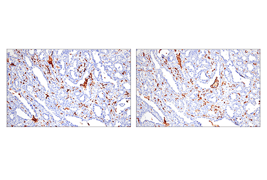 Immunohistochemistry Image 3: Iba1/AIF-1 (E4O4W) Rabbit Monoclonal Antibody (BSA and Azide Free)