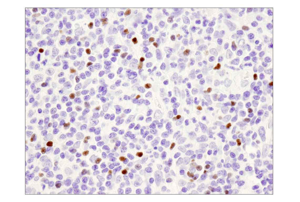 Immunohistochemistry Image 2: FoxP3 (D2W8E<sup>™</sup>) Rabbit mAb
