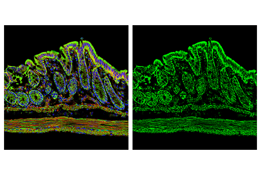 Immunofluorescence Image 1: MAVS (E8Z7M) Rabbit Monoclonal Antibody