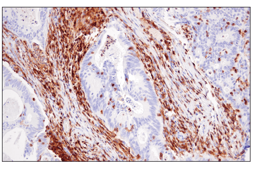 Immunohistochemistry Image 1: CD48 (D7L8I) Rabbit Monoclonal Antibody (BSA and Azide Free)
