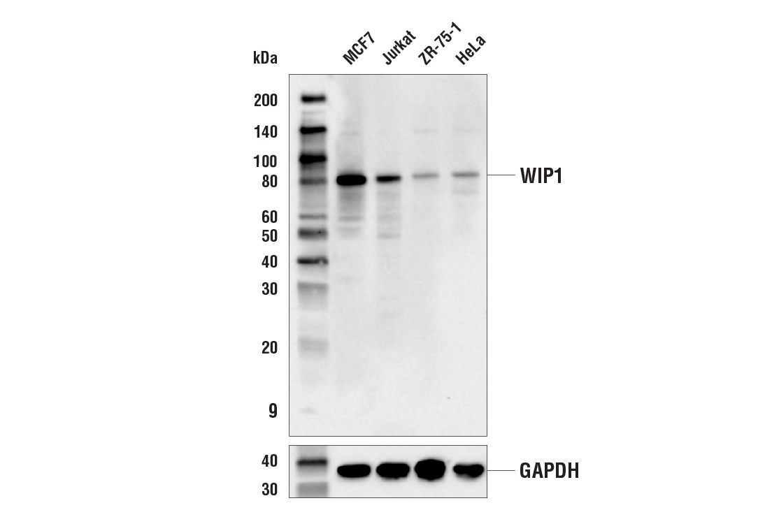 Western Blotting Image 1: WIP1 (E2X1I) Rabbit mAb