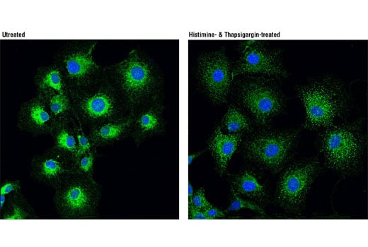 Immunofluorescence Image 1: STIM1 (D88E10) Rabbit Monoclonal Antibody