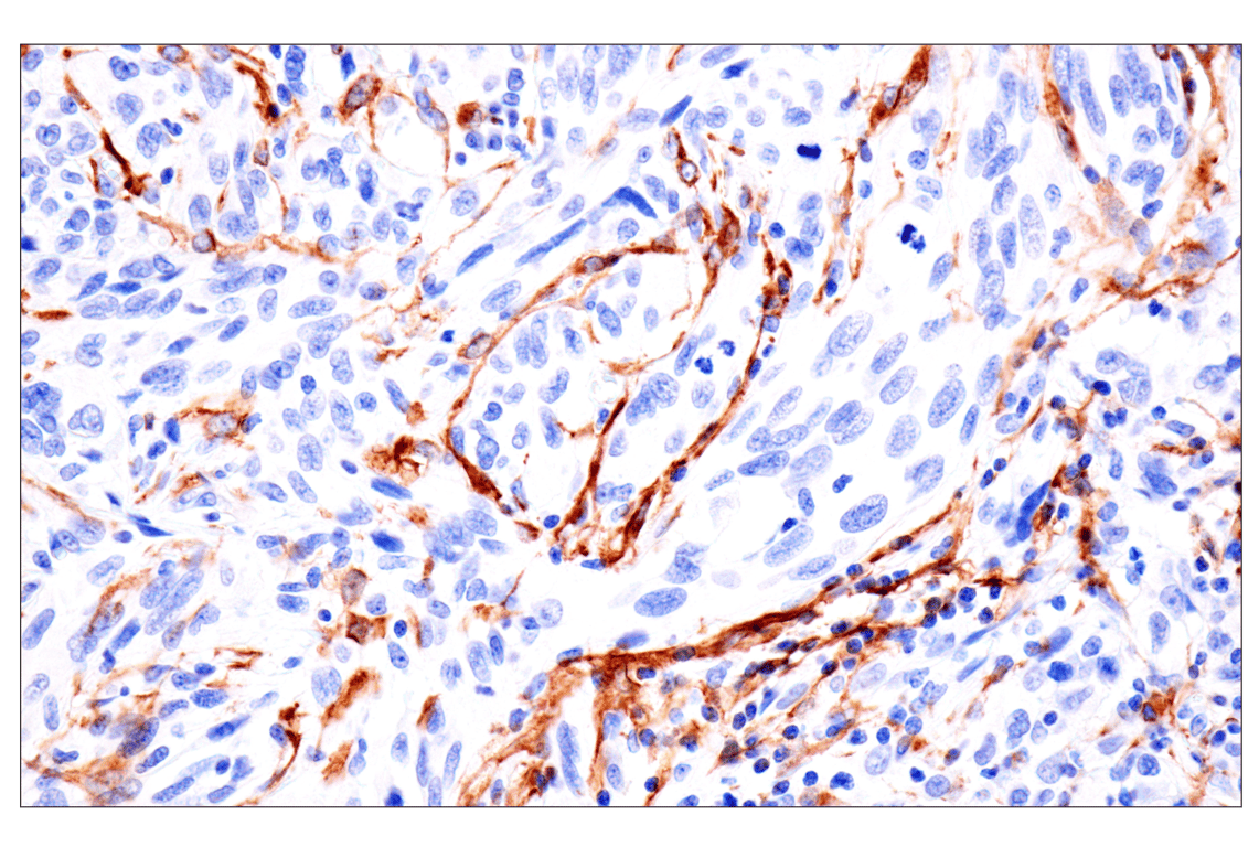 Immunohistochemistry Image 10: FAP (F1A4G) Rabbit Monoclonal Antibody