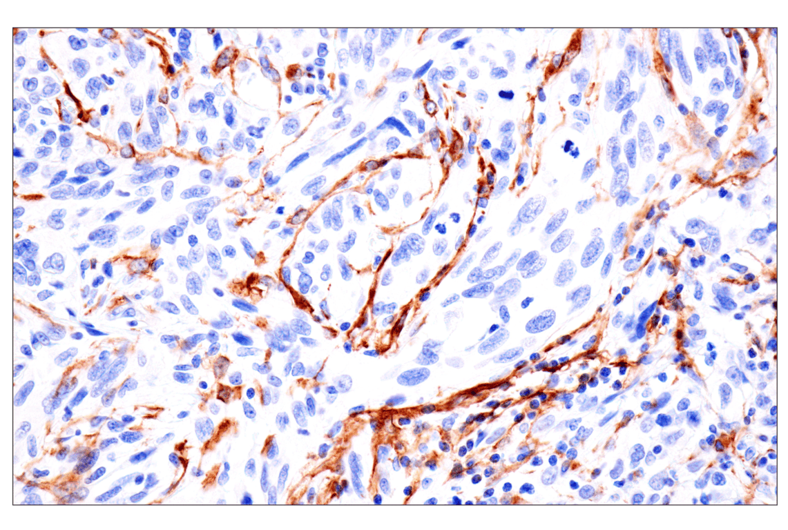 Immunohistochemistry Image 10: FAP (F1A4G) Rabbit mAb