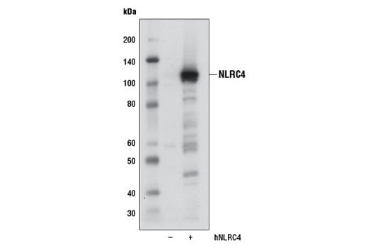 undefined Image 10: Human Reactive Inflammasome Antibody Sampler Kit II