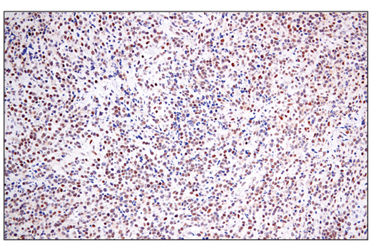 Immunohistochemistry Image 4: RAI17/ZMIZ1 (E2X3X) Rabbit Monoclonal Antibody