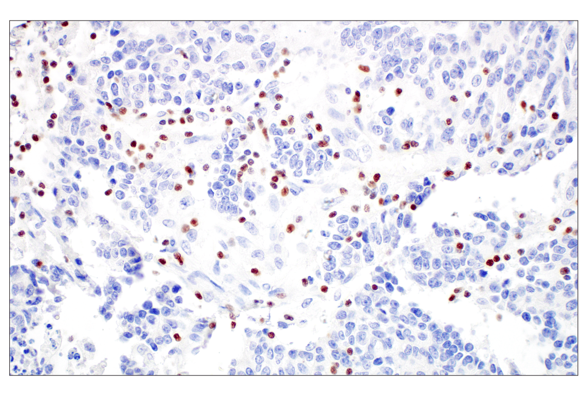 Immunohistochemistry Image 3: T-bet/TBX21 (E4I2K) Rabbit Monoclonal Antibody (BSA and Azide Free)