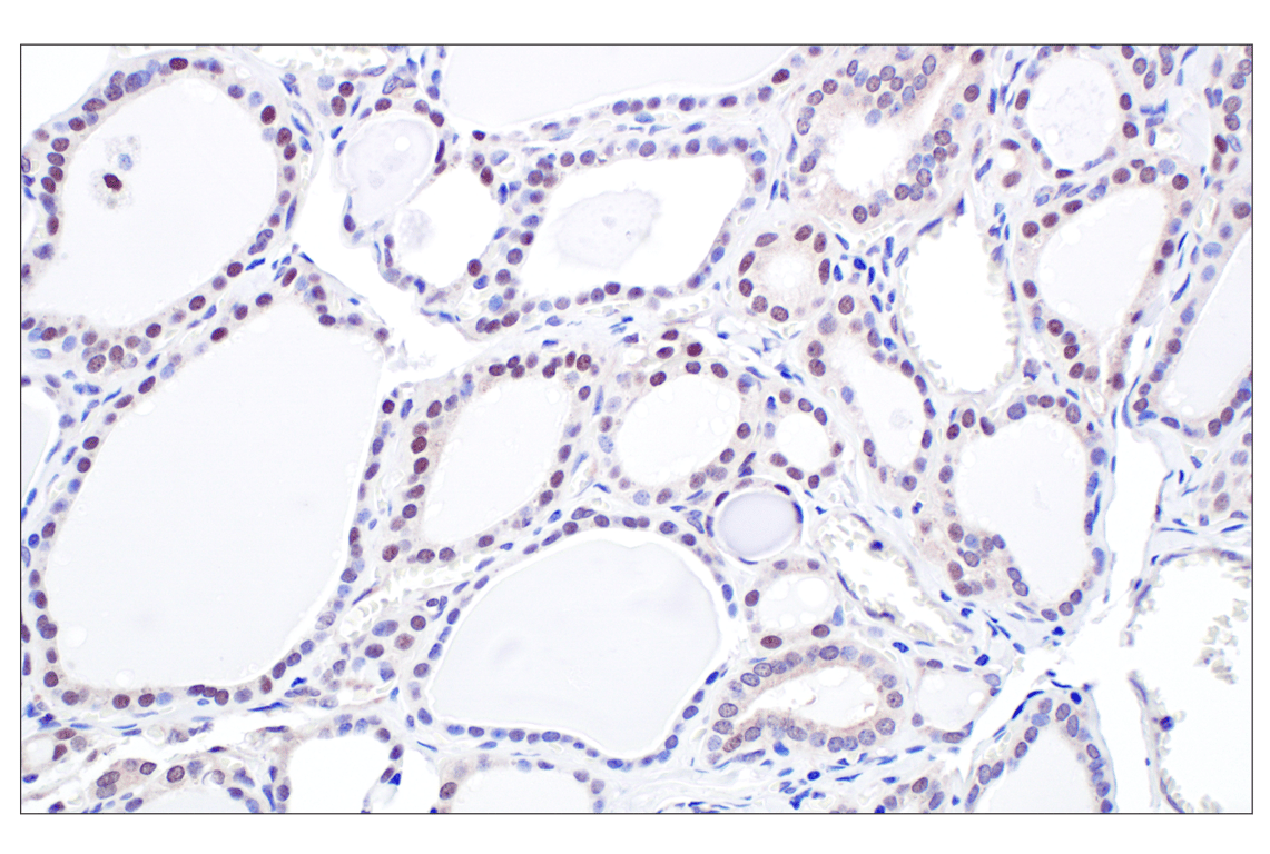 Immunohistochemistry Image 8: TFE3 (F3Z2Q) Rabbit Monoclonal Antibody