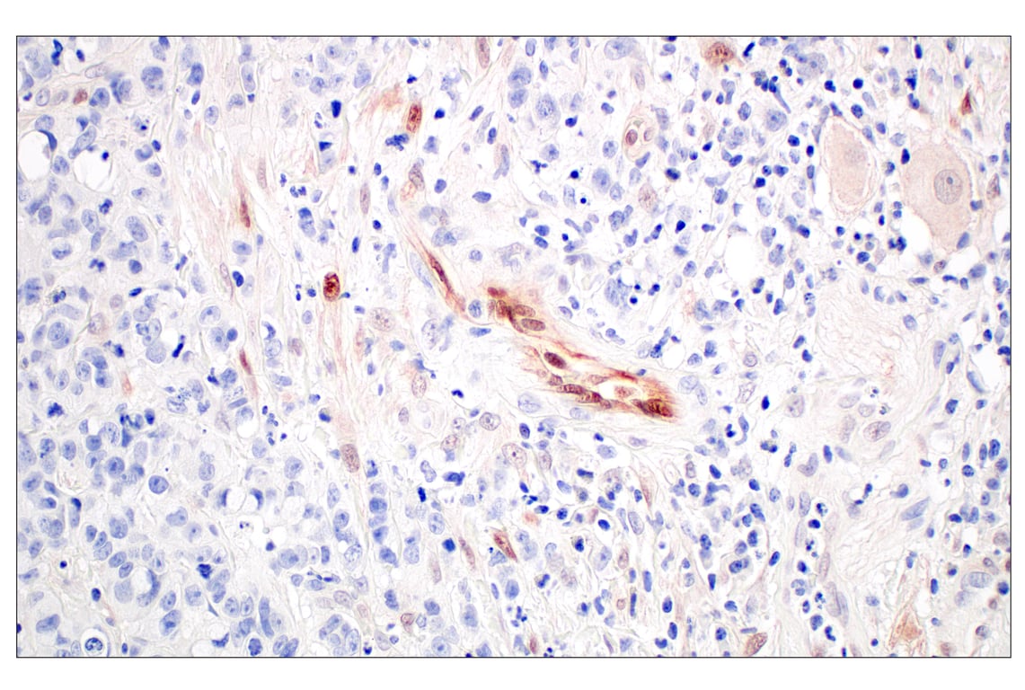 Immunohistochemistry Image 5: ARK5 (E4T2A) Rabbit Monoclonal Antibody