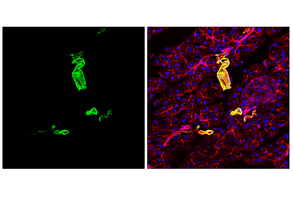 Immunofluorescence Image 2: Transgelin/TAGLN (F3B7H) Rabbit Monoclonal Antibody