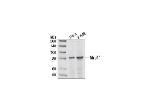 undefined Image 9: Double Strand Breaks (DSB) Repair Antibody Sampler Kit