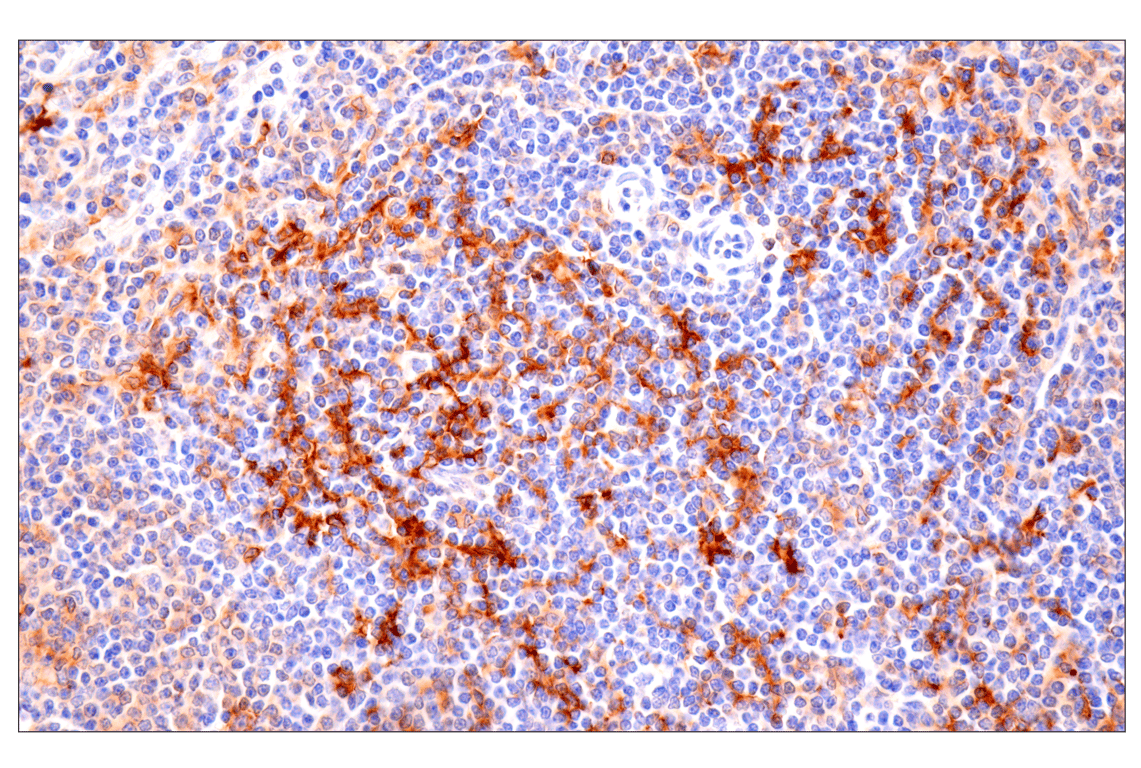 Immunohistochemistry Image 2: CD86 (E2G8P) Rabbit Monoclonal Antibody