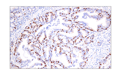 Immunohistochemistry Image 2: Geminin (E5Q9S) Rabbit Monoclonal Antibody (BSA and Azide Free)