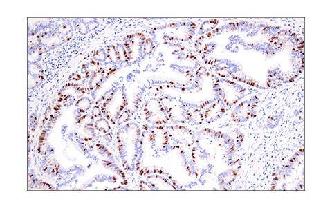 Immunohistochemistry Image 2: Geminin (E5Q9S) XP<sup>®</sup> Rabbit mAb (BSA and Azide Free)