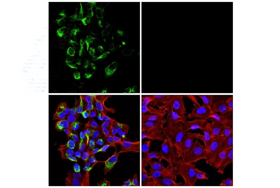 Immunofluorescence Image 1: Neurofilament-M (E9N8K) Mouse Monoclonal Antibody