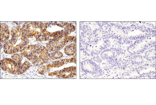 cycs 分化　13号 Non-phospho (Active) β-Catenin (Ser45) (D2U8Y) XP® Rabbit