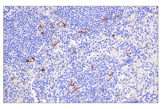 Immunohistochemistry Image 4: Cleaved Gasdermin D (Asp275) (E7H9G) Rabbit Monoclonal Antibody